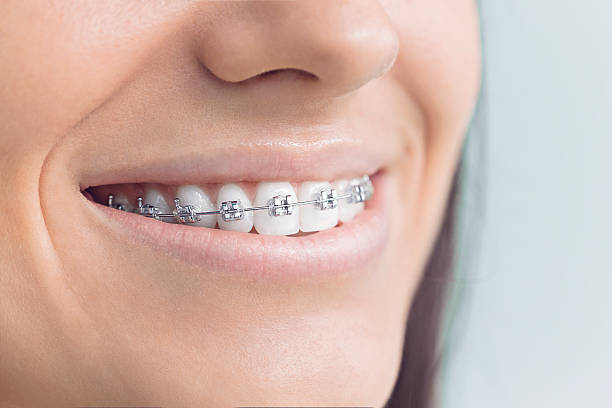 Best Veneers and Lumineers  in Jim Thorpe, PA